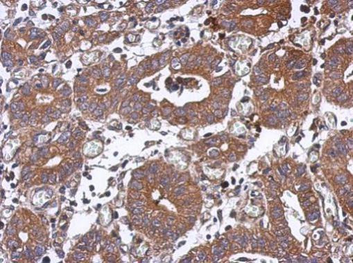 PPM1J Antibody in Immunohistochemistry (Paraffin) (IHC (P))