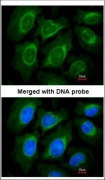 NOV Antibody in Immunocytochemistry (ICC/IF)