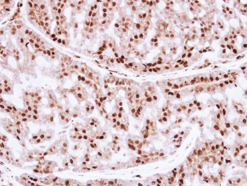 ZNF323 Antibody in Immunohistochemistry (Paraffin) (IHC (P))