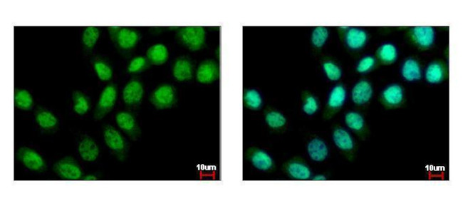 ZMYND11 Antibody in Immunocytochemistry (ICC/IF)