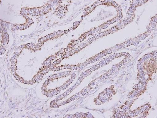 HYAL1 Antibody in Immunohistochemistry (Paraffin) (IHC (P))