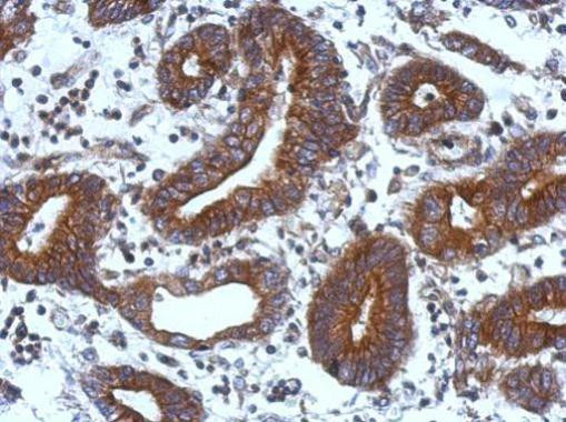 TIE1 Antibody in Immunohistochemistry (Paraffin) (IHC (P))