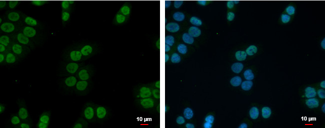 ZNF45 Antibody in Immunocytochemistry (ICC/IF)