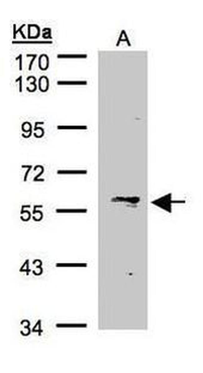 IFIT1 Antibody in Western Blot (WB)