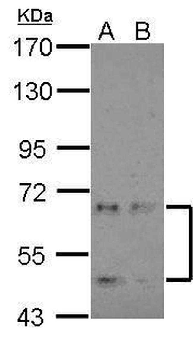 NKIAMRE Antibody in Western Blot (WB)