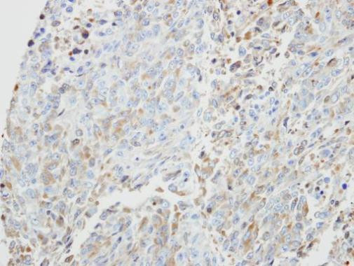 PRKX Antibody in Immunohistochemistry (Paraffin) (IHC (P))