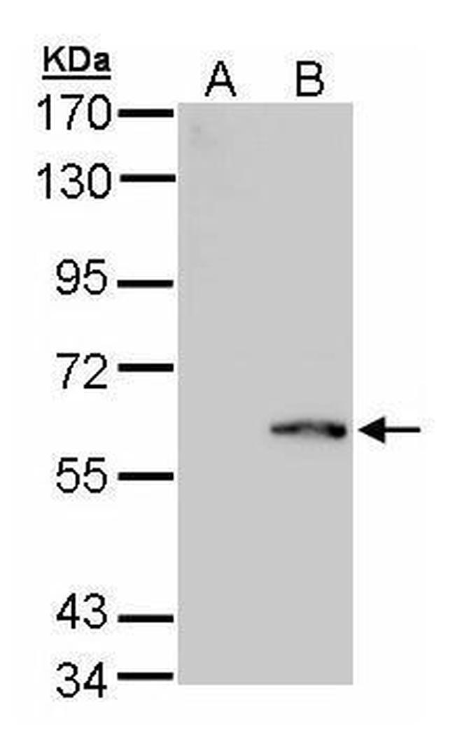 FPGS Antibody in Western Blot (WB)