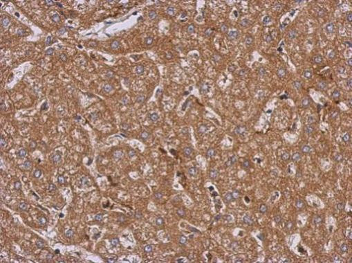 LRRN2 Antibody in Immunohistochemistry (Paraffin) (IHC (P))