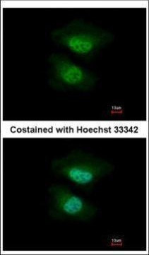 NAB2 Antibody in Immunocytochemistry (ICC/IF)