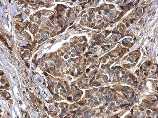Synaptotagmin 1 Antibody in Immunohistochemistry (Paraffin) (IHC (P))