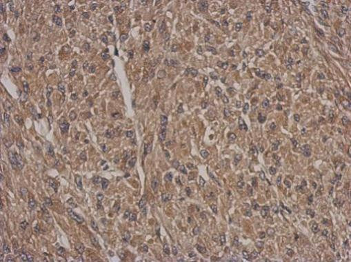 HSF2BP Antibody in Immunohistochemistry (Paraffin) (IHC (P))