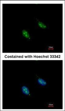 RFC3 Antibody in Immunocytochemistry (ICC/IF)