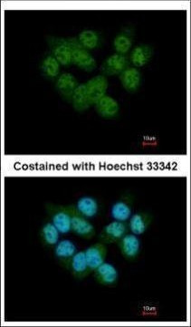 SEPHS2 Antibody in Immunocytochemistry (ICC/IF)