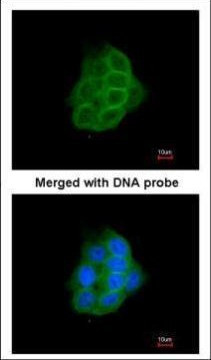 PCDH1 Antibody in Immunocytochemistry (ICC/IF)