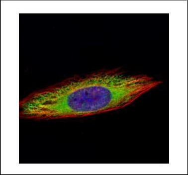 ENO3 Antibody in Immunocytochemistry (ICC/IF)