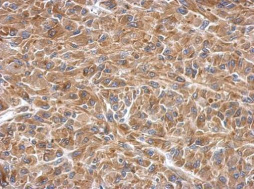 SLK Antibody in Immunohistochemistry (Paraffin) (IHC (P))