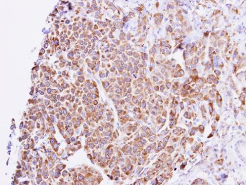 GNAL Antibody in Immunohistochemistry (Paraffin) (IHC (P))