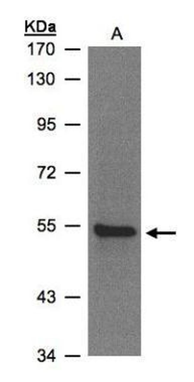 ZNF157 Antibody in Western Blot (WB)
