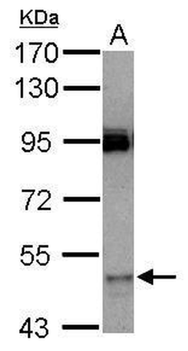CYP3A7 Antibody in Western Blot (WB)