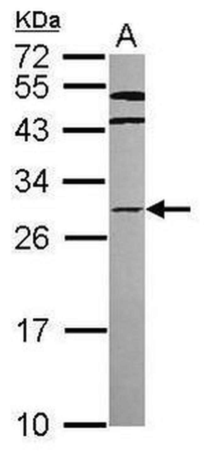 HOXC8 Antibody in Western Blot (WB)