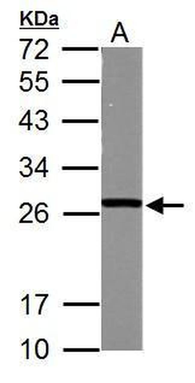 GSTM5 Antibody in Western Blot (WB)