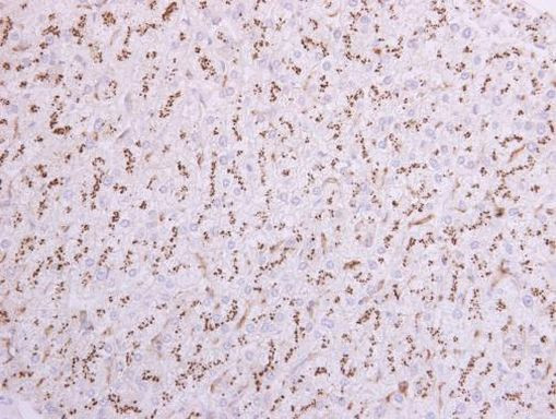 ST6GAL1 Antibody in Immunohistochemistry (Paraffin) (IHC (P))