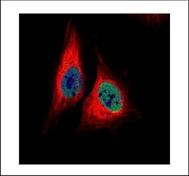 TEAD4 Antibody in Immunocytochemistry (ICC/IF)