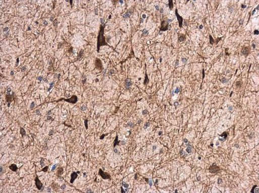 GABRA1 Antibody in Immunohistochemistry (Paraffin) (IHC (P))