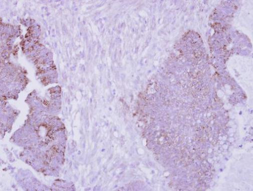 Arginase 2 Antibody in Immunohistochemistry (Paraffin) (IHC (P))