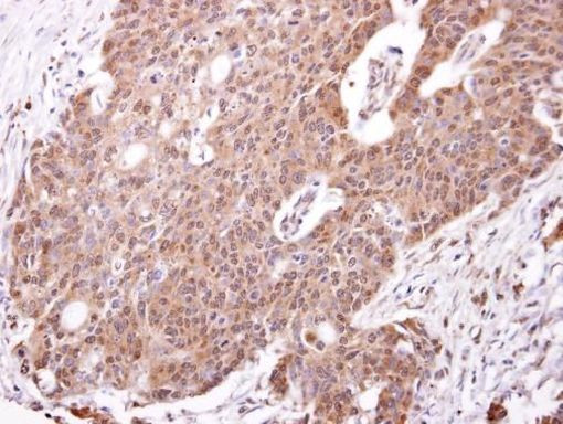 PLK3 Antibody in Immunohistochemistry (Paraffin) (IHC (P))