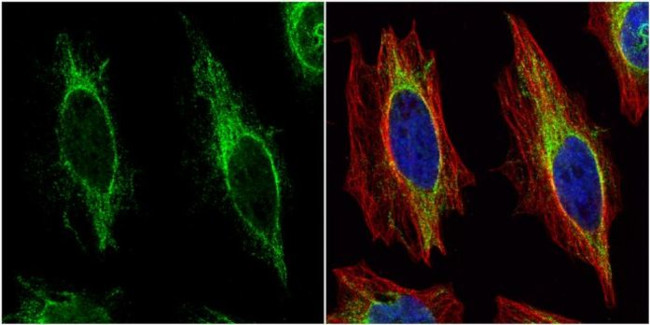 Cytokeratin 14 Antibody in Immunocytochemistry (ICC/IF)