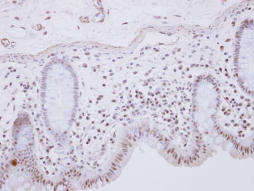 RCL1 Antibody in Immunohistochemistry (Paraffin) (IHC (P))