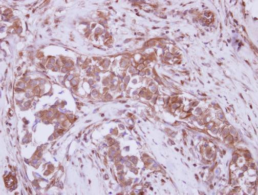 P2X7 Antibody in Immunohistochemistry (Paraffin) (IHC (P))