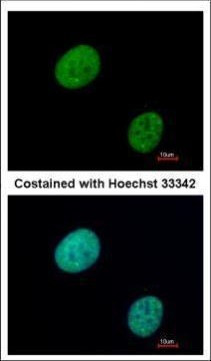 GLI3 Antibody in Immunocytochemistry (ICC/IF)