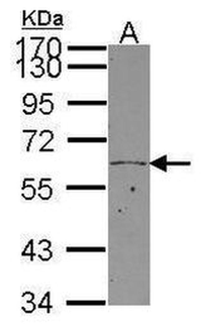 KLF11 Antibody in Western Blot (WB)