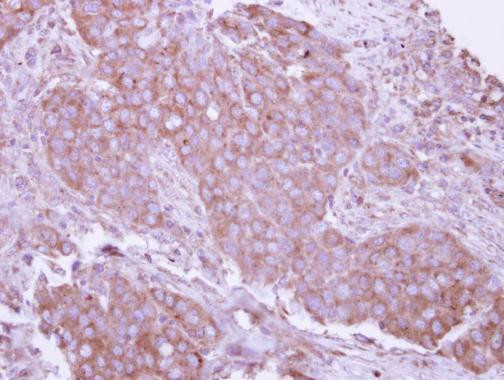 CD27 Antibody in Immunohistochemistry (Paraffin) (IHC (P))