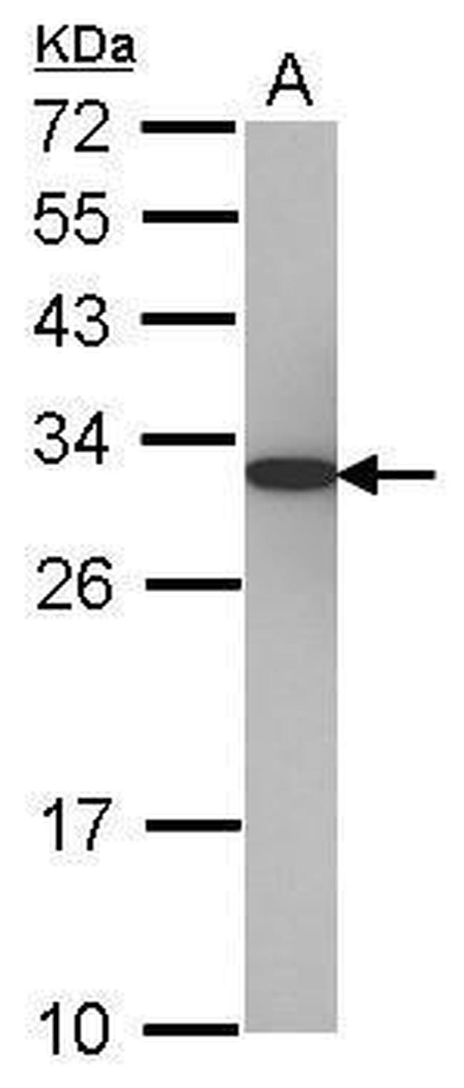 PSME1 Antibody in Western Blot (WB)