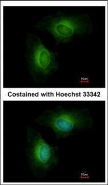 CYP1B1 Antibody in Immunocytochemistry (ICC/IF)