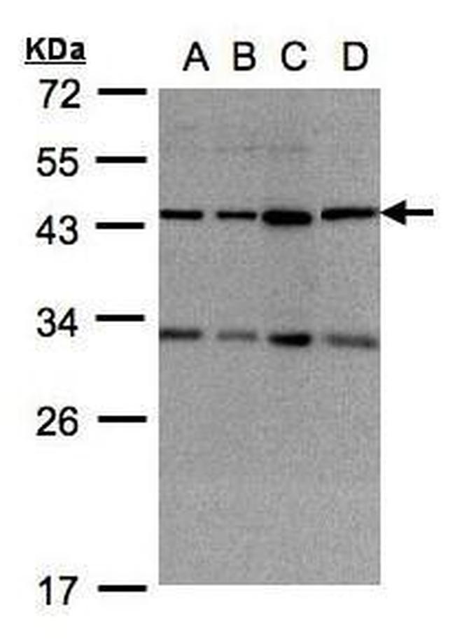 DNAJC17 Antibody in Western Blot (WB)