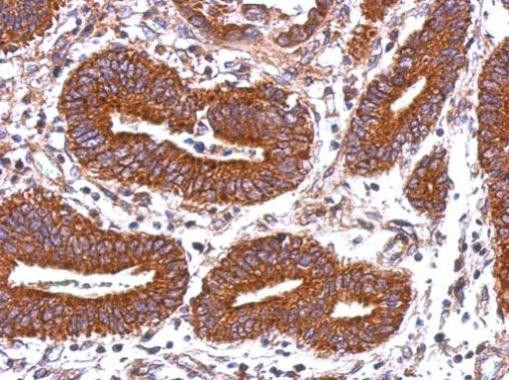 HLA-DQB2 Antibody in Immunohistochemistry (Paraffin) (IHC (P))