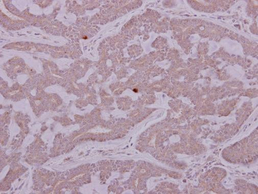 PCYT2 Antibody in Immunohistochemistry (Paraffin) (IHC (P))
