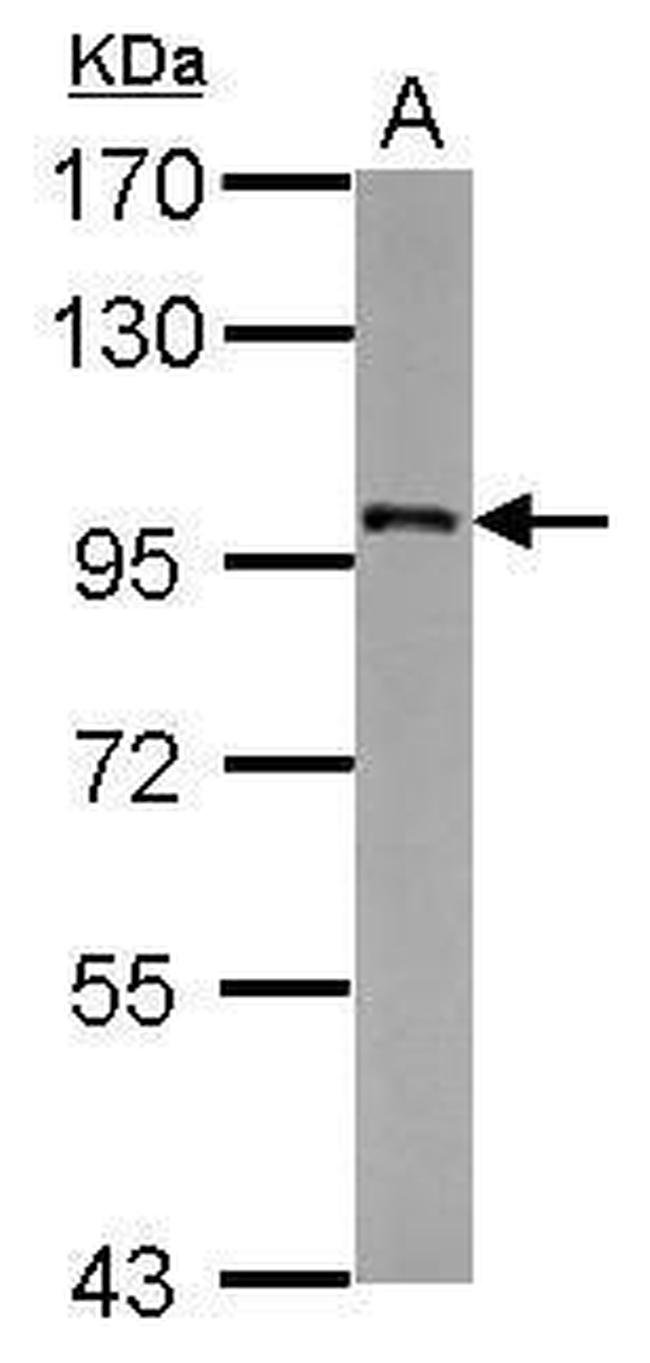 FAM48A Antibody in Western Blot (WB)