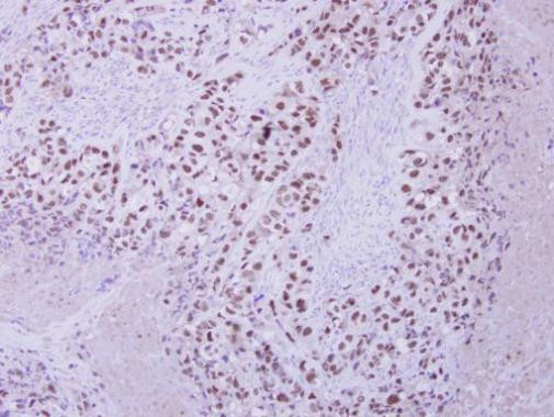 ZNF217 Antibody in Immunohistochemistry (Paraffin) (IHC (P))