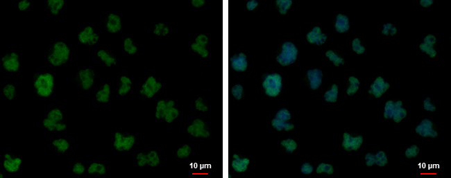 FUBP1 Antibody in Immunocytochemistry (ICC/IF)