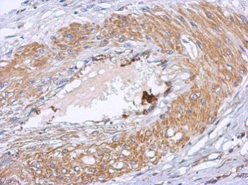 DTNB Antibody in Immunohistochemistry (Paraffin) (IHC (P))