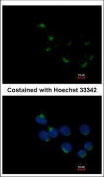 GALNT6 Antibody in Immunocytochemistry (ICC/IF)