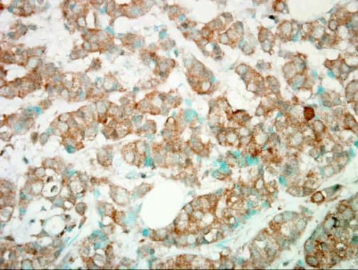PIK3CG Antibody in Immunohistochemistry (Paraffin) (IHC (P))