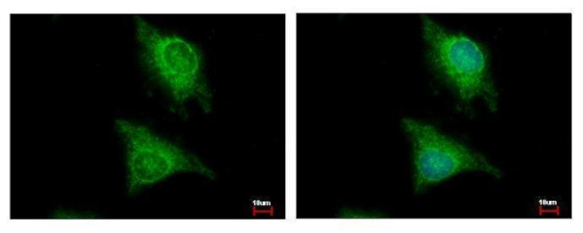 EPM2A Antibody in Immunocytochemistry (ICC/IF)