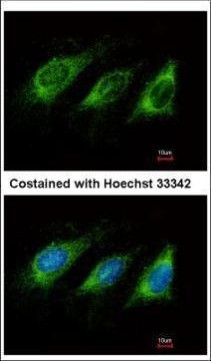 AID Antibody in Immunocytochemistry (ICC/IF)