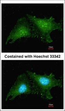 RNF25 Antibody in Immunocytochemistry (ICC/IF)